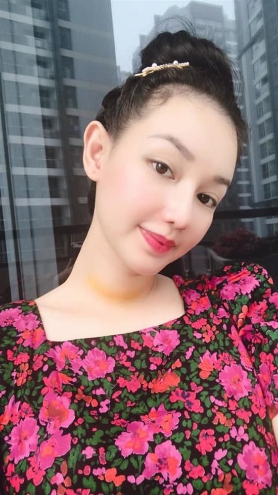 Không nhận ra MC Quỳnh Chi sau 1 năm phẫu thuật vì ung thư