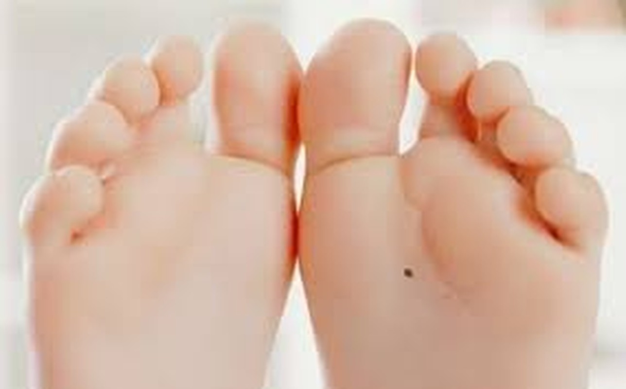 3 nốt ruồi phúc khí suôn sẻ, sự nghiệp hanh thông - Hình 9 3 not ruoi phuc khi suon se, su nghiep hanh thong-Hinh-9