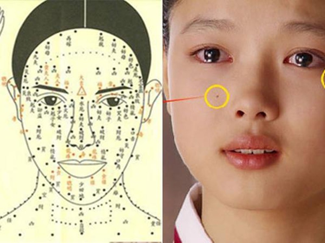 3 nốt ruồi phúc khí suôn sẻ, sự nghiệp hanh thông 3 not ruoi phuc khi suon se, su nghiep hanh thong