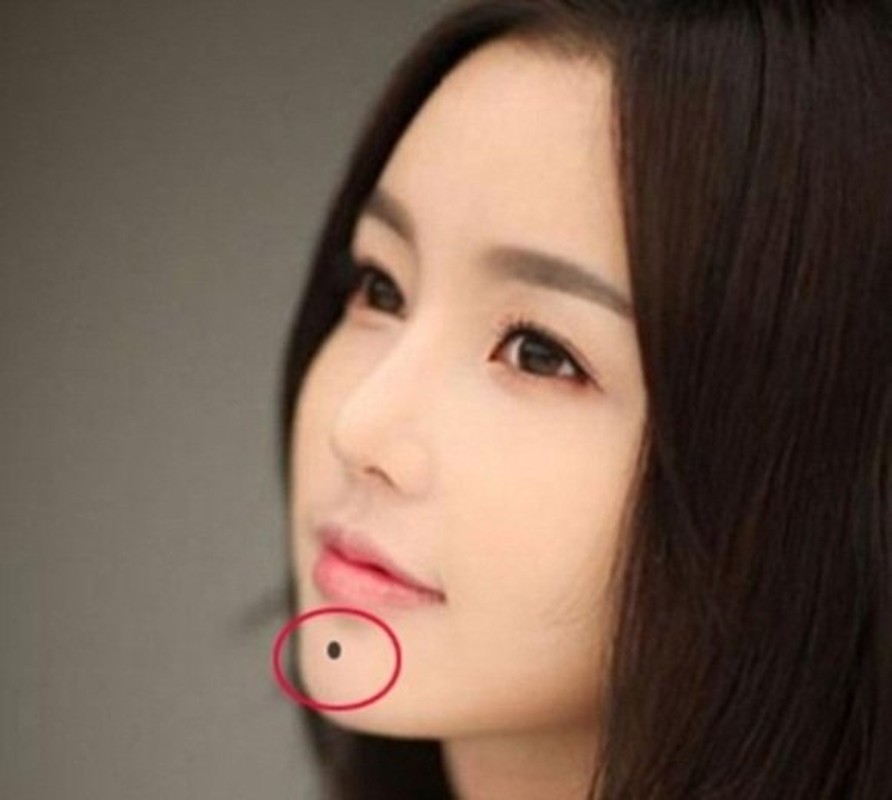 7 nốt ruồi vượng tướng tu 10 đời mới có, đừng dại tẩy đi - Hình 11 7 not ruoi vuong tuong tu 10 doi moi co, dung dai tay di-Hinh-11