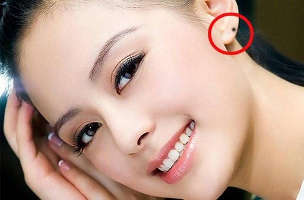 7 nốt ruồi vượng tướng tu 10 đời mới có, đừng dại tẩy đi - Hình 6 7 not ruoi vuong tuong tu 10 doi moi co, dung dai tay di-Hinh-6