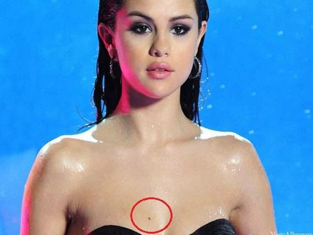7 nốt ruồi vượng tướng tu 10 đời mới có, đừng dại tẩy đi - Hình 8 7 not ruoi vuong tuong tu 10 doi moi co, dung dai tay di-Hinh-8