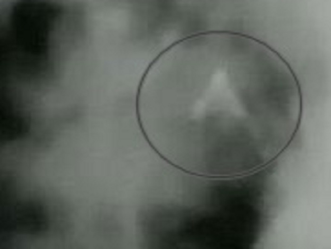 Camera vo tinh chup duoc anh nghi UFO o Romania-Hinh-2
