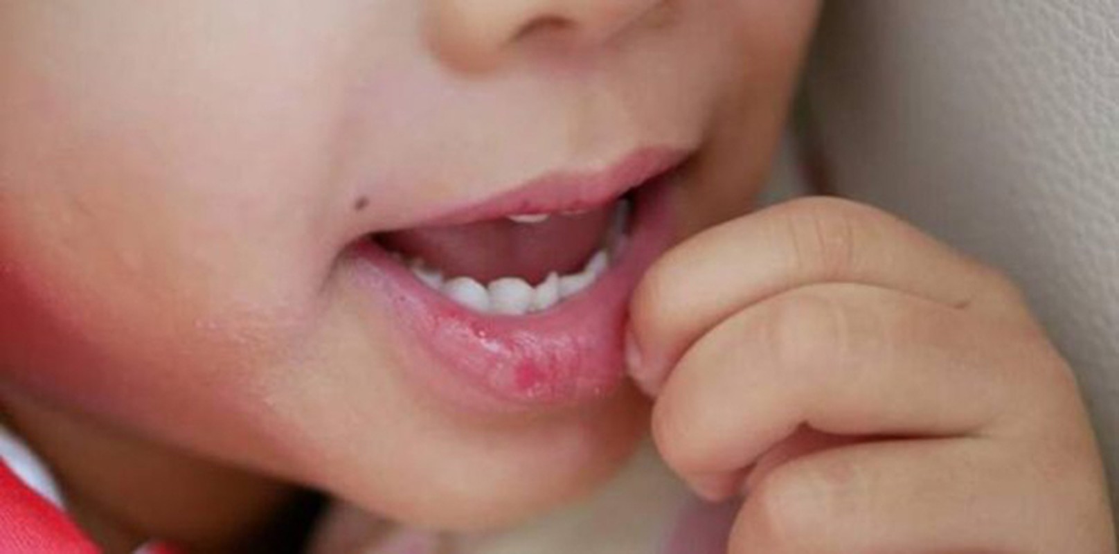 Giật mình lý do trẻ nẻ môi, rỉ máu vào mùa đông - Hình 10 Giat minh ly do tre ne moi, ri mau vao mua dong-Hinh-10