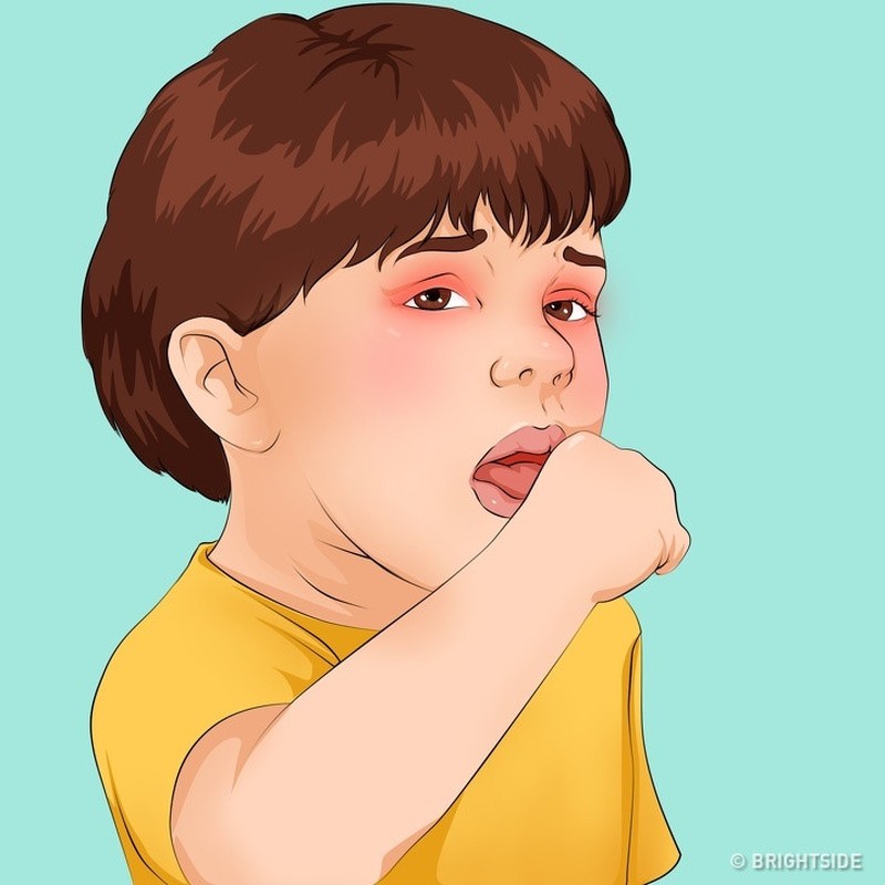Dấu hiệu nhận biết 10 căn bệnh nguy hiểm ở trẻ em - Hình 3 Dau hieu nhan biet 10 can benh nguy hiem o tre em-Hinh-3