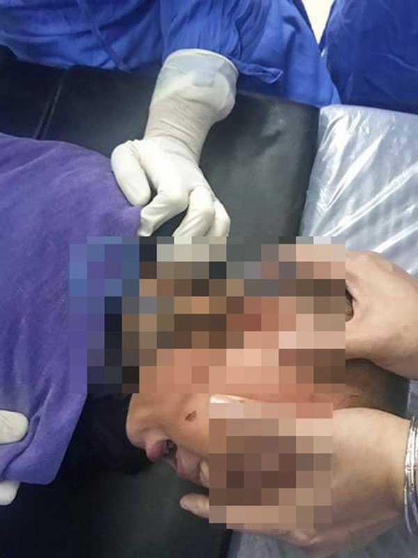 Xót xa trẻ gặp tai nạn thương tâm vì cha mẹ bất cẩn - Hình 8 Xot xa tre gap tai nan thuong tam vi cha me bat can-Hinh-8