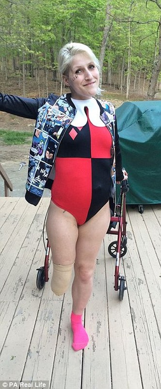 Женщины Инвалиды Без Ног Знакомства